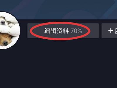 如何改抖音账号名称