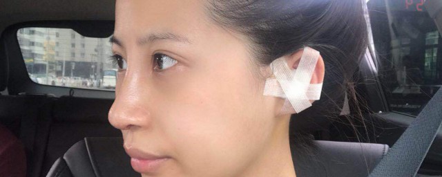 鼻头大缩小自然方法 关于鼻头大缩小自然方法