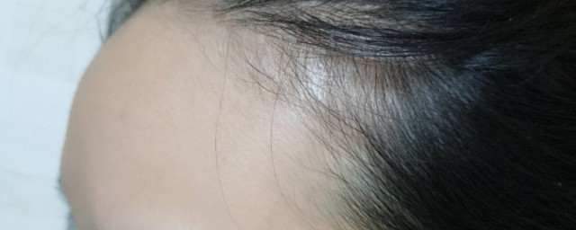 女生额头高怎么办 女生额头高解决方法