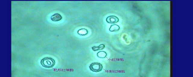镜检红细胞什么意思 镜检红细胞介绍
