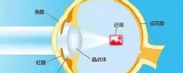 眼镜轴距是指什么 眼镜轴距指的是什么