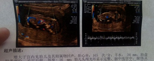 nt是什么意思? nt指的是什么