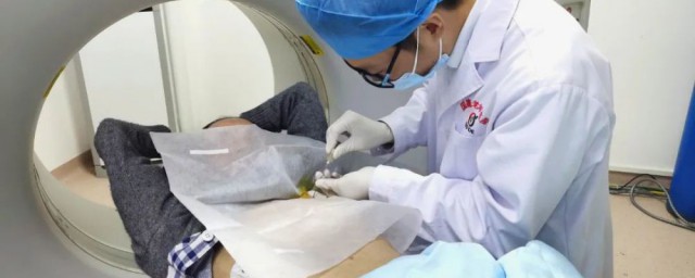 穿刺活检是什么意思 穿刺活检的意思是什么