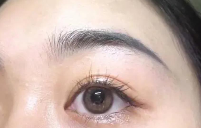 隐形眼镜滑片解决方法是什么