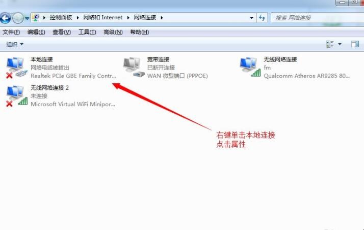 怎么设置本地连接ip地址