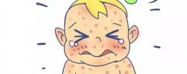 水痘会通过什么传染 水痘如何传染