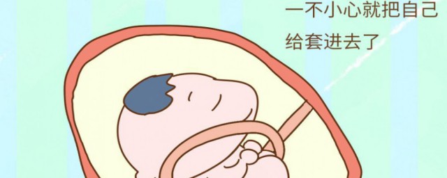 脐带绕颈和睡姿有关吗 脐带绕颈的原因