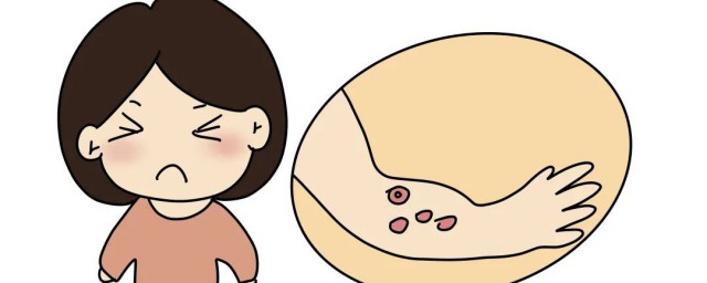 烫出泡了如何处理办法 烫伤后起水泡处理方式