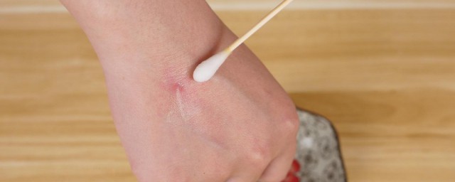 土方法什么消肿最快 土方法啥消肿最快
