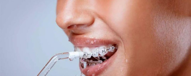 冲牙器正确使用方法 冲牙器正确使用方法是什么