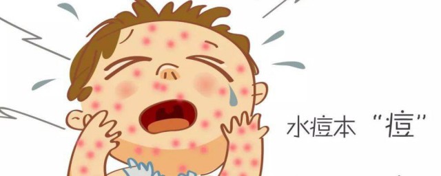 出水痘不能吃什么食物 水痘忌口的食物有哪些