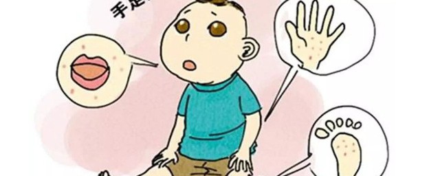 手口足病的症状初期要注意什么 手口足病的症状会传染吗