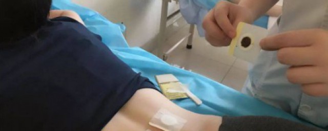 贴三伏贴注意能吃什么 贴三伏贴应该注意什么事项