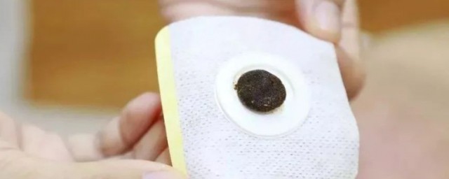 三伏贴起泡涂什么 三伏贴起泡怎么处理