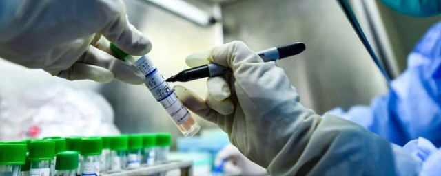 自费核酸检测一次多少钱 核酸检测都要自费吗