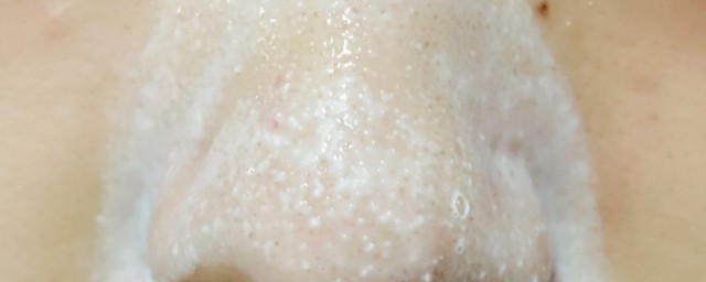 撕黑头的正确方法 怎么撕黑头