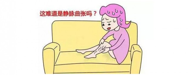 静脉曲张锻炼最好方法 静脉曲张是什么
