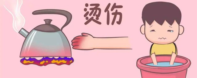 手被烫伤后怎么处理 手被烫伤后的处理方法介绍