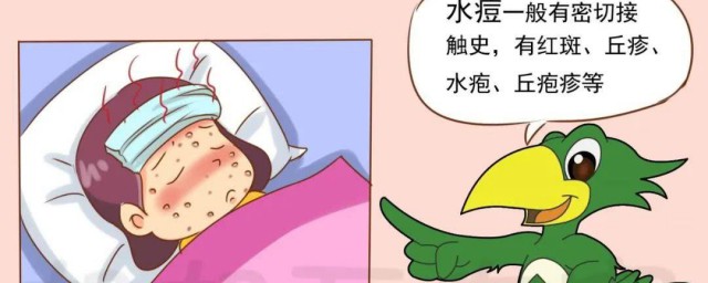 水痘怎么处理 出水痘的处理方法介绍