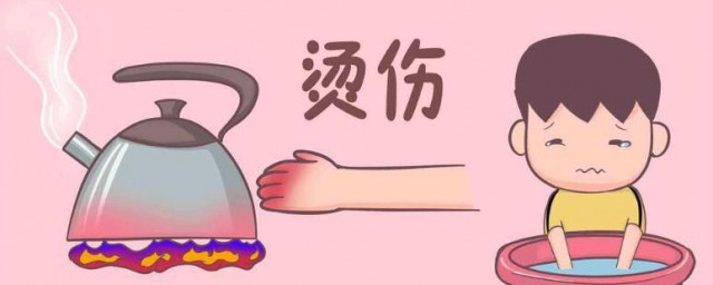 被烫伤怎么处理 被烫伤怎么办
