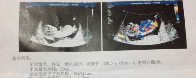 nt啥意思 nt简单介绍