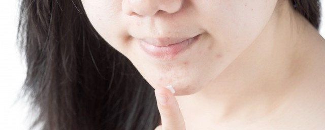 维生素b6可以治痘痘 维生素b6治疗痘痘有效果吗