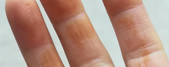 为什么人醒了手有锈 睡醒手上有锈是因为什么原因