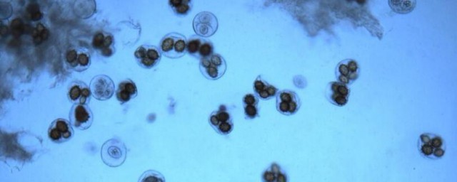 酵母菌从繁殖方式分为几类 酵母菌从繁殖方式分为多少类