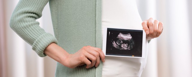 孕妇坐飞机过安检门怎样办 孕妇坐飞机过安检门需要注意什么