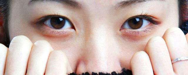 有什么去除黑眼圈妙招 去除黑眼圈的三个小妙招