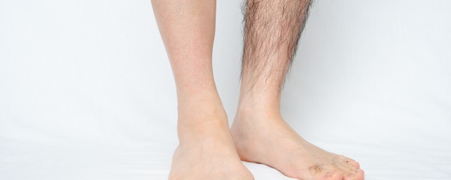 腿毛太多如何办男生 男人腿毛太多如何办