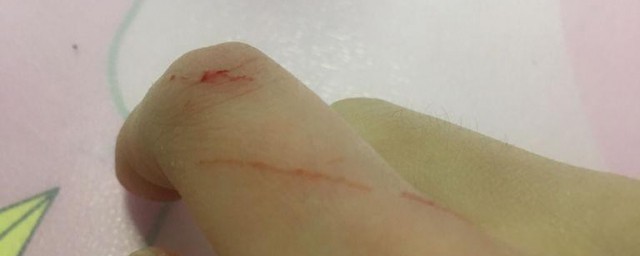 被猫抓了一定要打针吗 被猫抓了是不是一定要打针