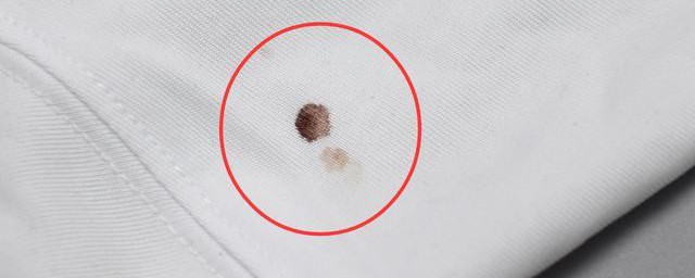 清洗血渍的最佳技巧 有效去除血渍的技巧简介