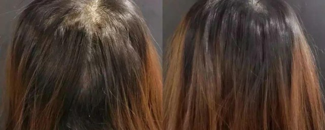 拯救头发油的办法 拯救头发油的6个妙招
