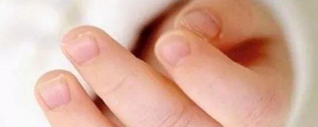 小孩吃手指头怎么戒掉 小孩如何戒掉吃手指头