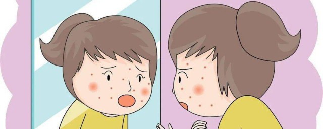 怎样样消除青春痘 消除青春痘的技巧简介