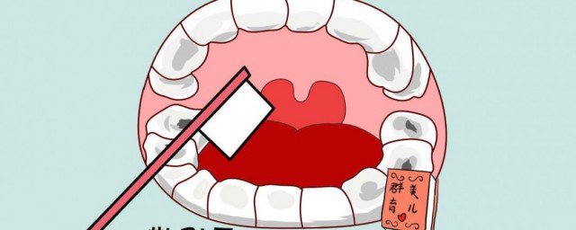 刷牙技巧及注意事项 刷牙的精确技巧和注意事项