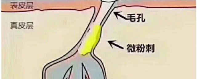 清理毛孔办法 如何清理毛孔