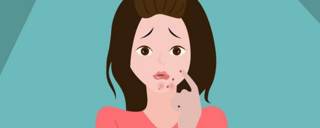 痘痘是怎样形成的 长痘痘的原因