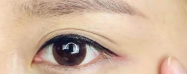 怎样让眼睛快速消肿 让眼睛快速消肿的诀窍有哪些