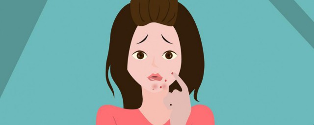 嘴唇周围长痘痘是什么原因 嘴唇周围长痘痘的原因分析