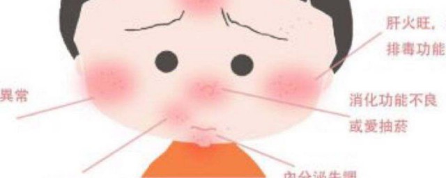 痘肌怎样不长痘 怎样养成不长痘肤质