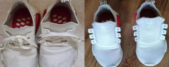鞋边发黄怎样快速变白 鞋边发黄是什么原因