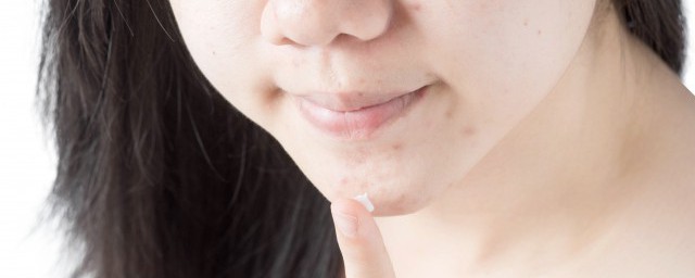 长痘怎样快速消除 长痘消除的技巧简介