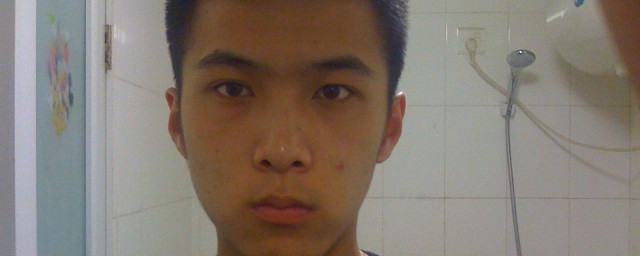 去青春痘技巧 去青春痘技巧是什么