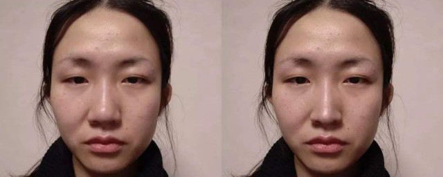 去泪沟的技巧 以下技巧都可以