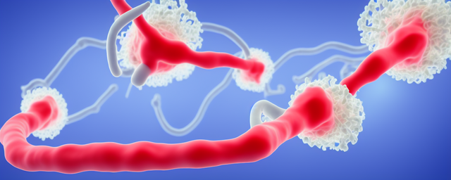 血清载脂蛋白a偏高的原因及危害 血清载脂蛋白a偏高的原因及危害
