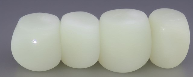 冰种白玉髓原石